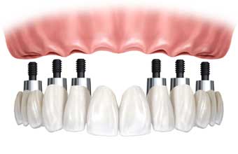 Claudia Renata Torres - Foto 1