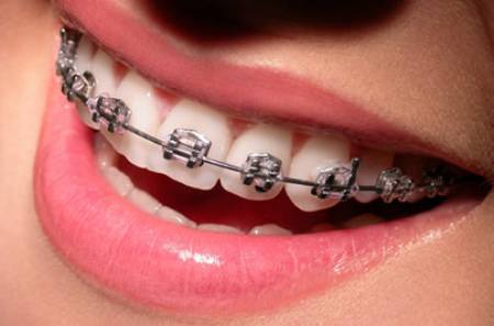 Grajaúdent Odontologia - Foto 3