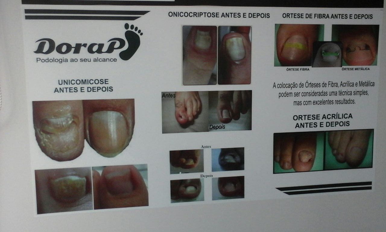 Dorape Podologia - Foto 3